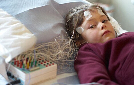 小儿脑电图正常能排除癫痫病吗